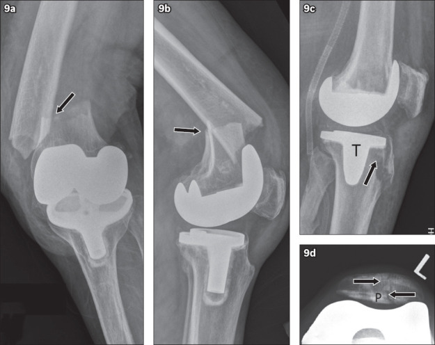 Fig. 9