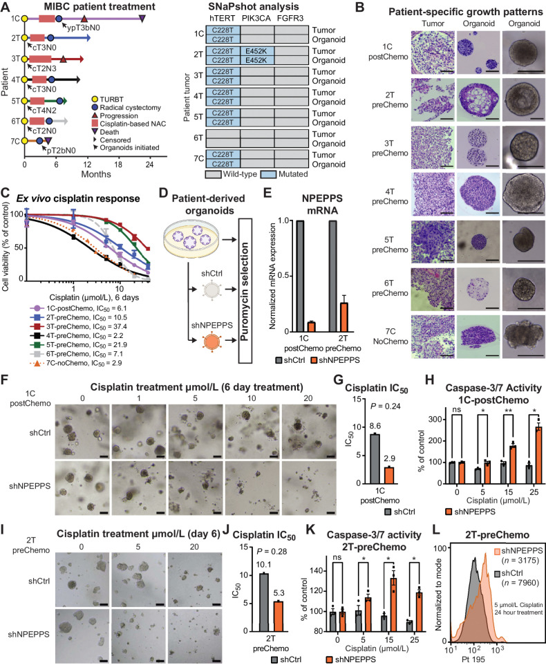 Figure 4. NPEPPS depletion sensitizes ex vivo models of bladder cancer to cisplatin. A, Clinical course of MIBC for patients including the point at which the patient tumor-derived organoid lines were generated (black arrow). Notation is the patient number followed by the tumor source, either TURBT, transurethral resection of bladder tumor (T), or radical cystectomy (C). B, Representative brightfield images of organoids together with H&E staining of patient tumor-PDO pairs illustrating patient-specific growth patterns. Most PDOs exhibited round and dense structures, as represented by 1C-postChemo (Chemo, cisplatin-based chemotherapy regimen), although there was notable variation in growth and morphology. Scale bar, 100 μm. C, Ex vivo response of all seven PDOs treated with increasing concentrations of cisplatin. Cell viability, as a percentage of untreated control, was measured using CellTiter-Glo. The fitted dose-response curves represent viability corresponding to three biological replicate experiments and data are represented as mean ± SEM. D, Experimental workflow for lentiviral, shRNA-mediated NPEPPS depletion in PDOs and representative images after puromycin selection. E, NPEPPS expression was evaluated by RT-PCR in shNPEPPS and shCtrl PDO lines normalized to cyclophilin. Error bars, mean ± SD. F, Representative brightfield images of the control and NPEPPS-depleted 1C-postChemo PDO treated with the indicated cisplatin concentrations. Scale bar, 400 μm. G, IC50 values estimated from dose curves for cell viability measured through CellTiter-Glo (biological triplicates; mean ± SEM). H, Relative caspase-3 and -7 activity in cisplatin-treated shCtrl and shNPEPPS PDOs. Caspase activity was measured by Caspase-Glo and normalized to untreated PDOs. (biological triplicates; mean ± SEM). I, J, and K, Replicate experimental conditions as in F, G, and H, but with the 2T-preChemo PDO. L, Intracellular cisplatin levels were measured after 24 hours of 5 μmol/L cisplatin treatment using CyTOF, with the number of live cells analyzed as indicated. *, P < 0.05; **, P < 0.01; ns, nonsignificant.