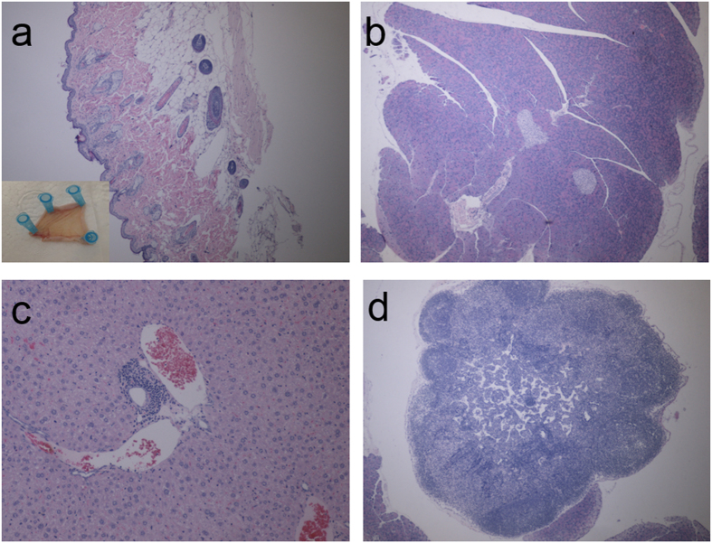 Figure 13