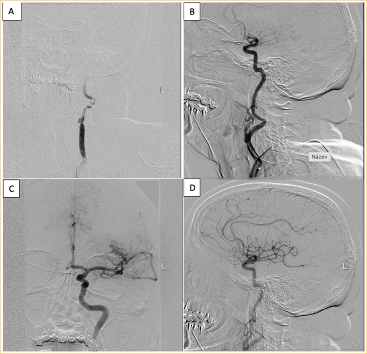 Fig 4