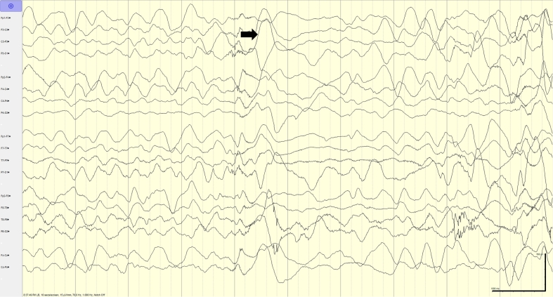 Fig. 3