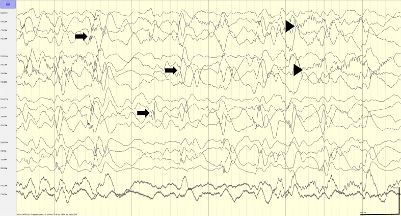 Fig. 2