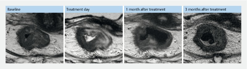 Fig. 4