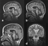 FIG. 10
