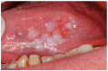 Fig. (3)