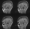 Fig 2