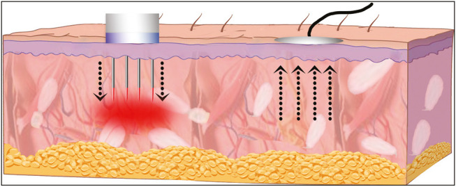 Figure 17