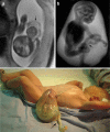 Fig. 20