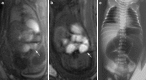 Fig. 10