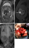 Fig. 12