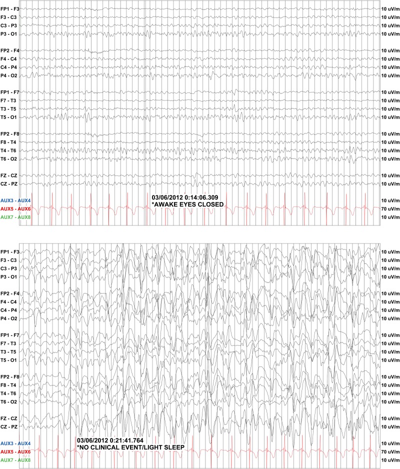 Figure 1