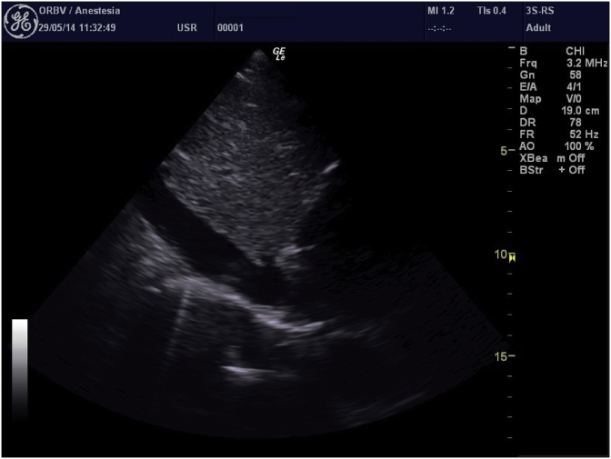 Fig. 1