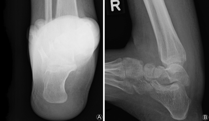 Fig. 2