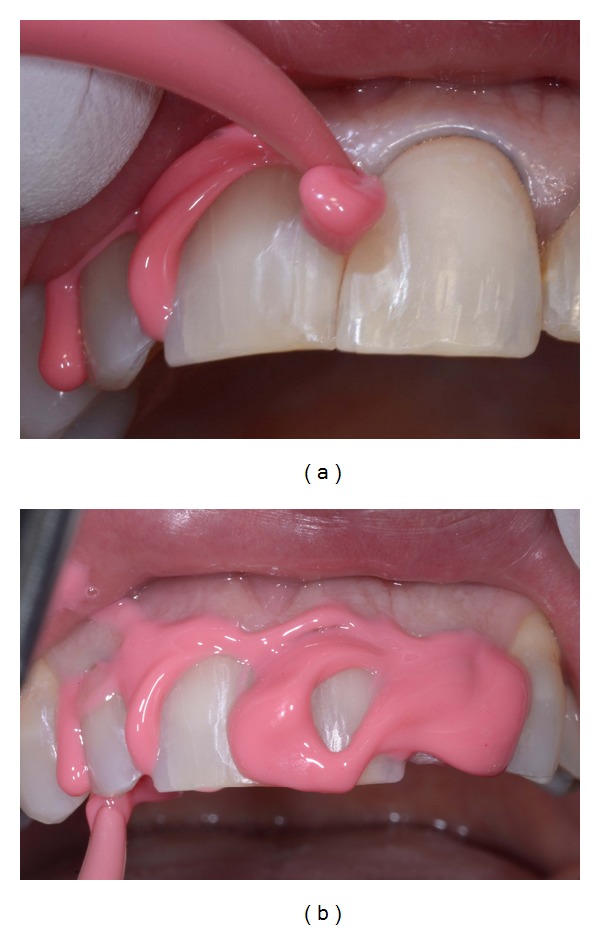 Figure 9