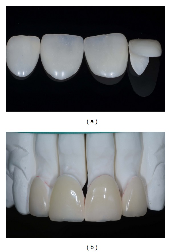 Figure 14