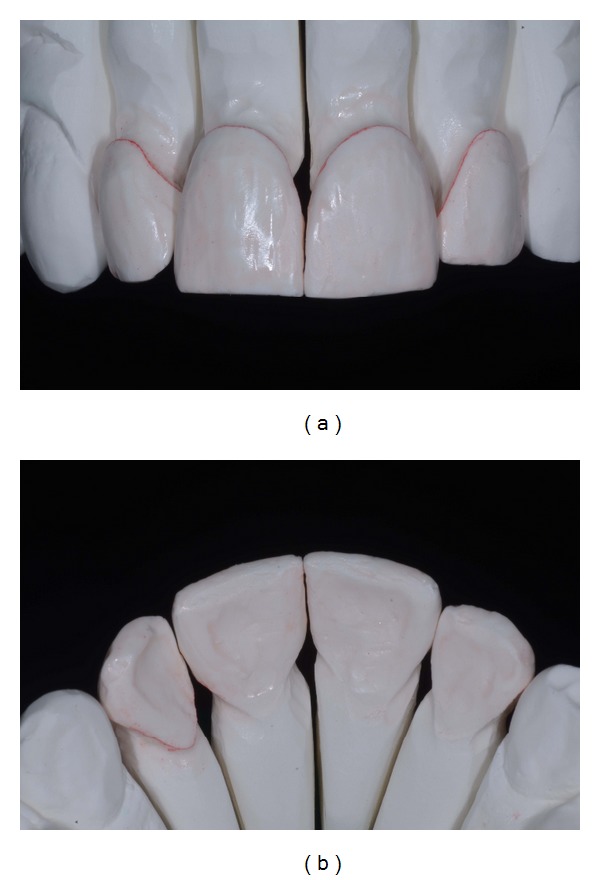 Figure 11