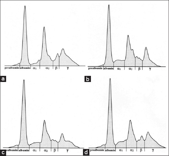 Figure-1