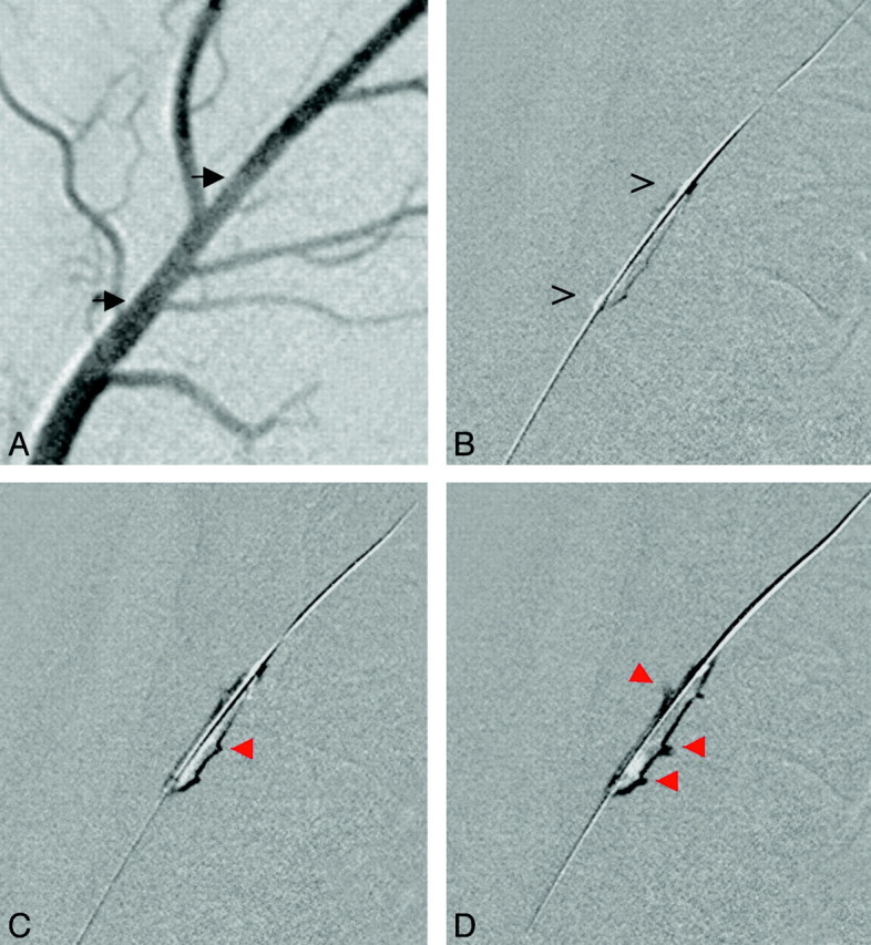 Fig 2.