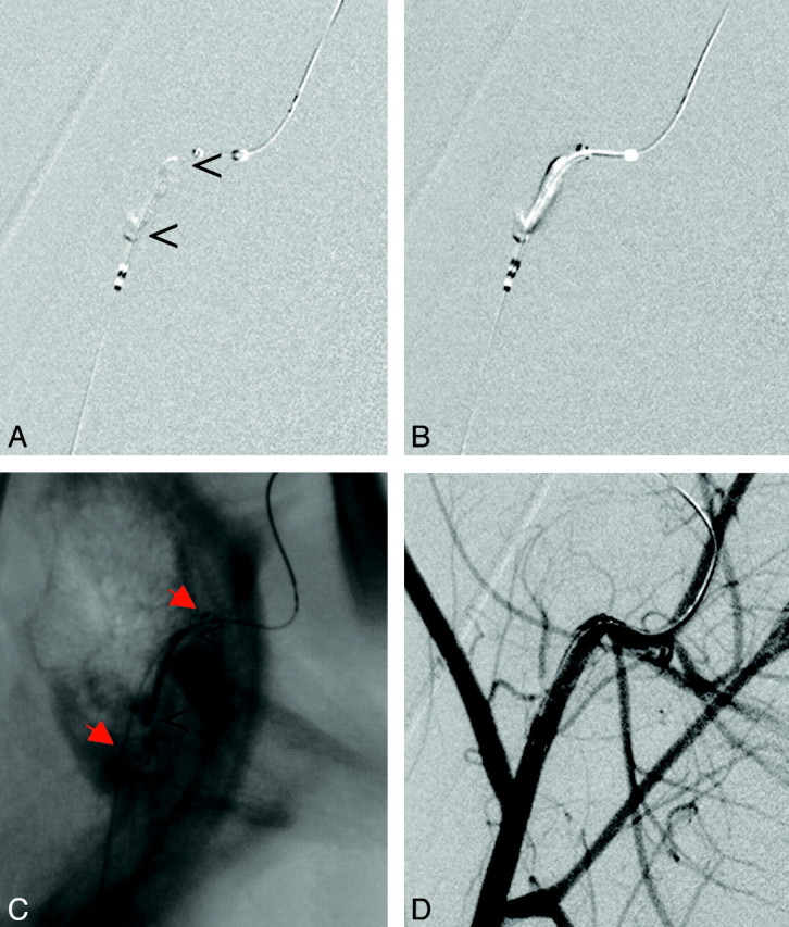 Fig 4.