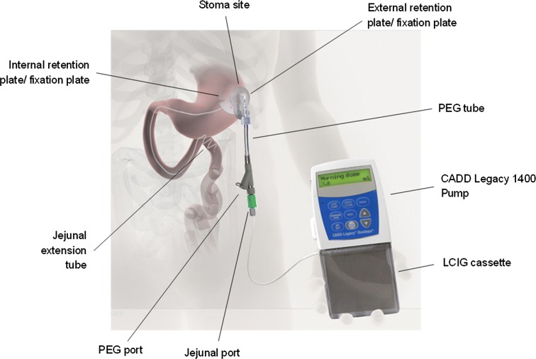 Fig. 1