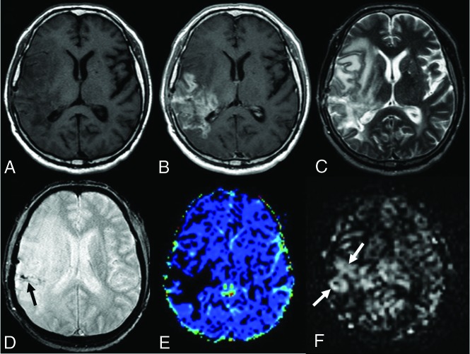 FIG 3.