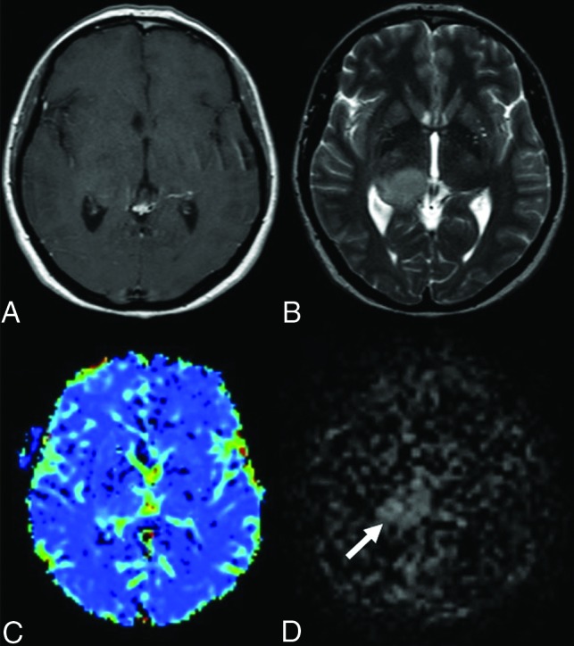 FIG 2.