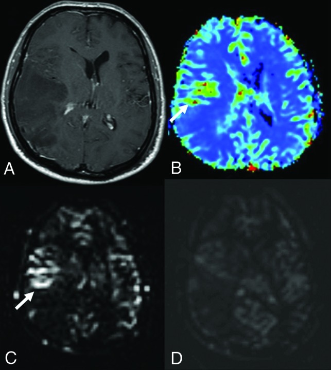 FIG 5.