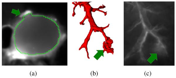 Fig. 14