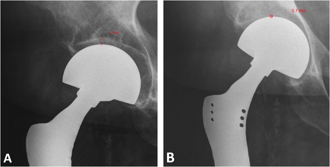 Fig. 1A-B