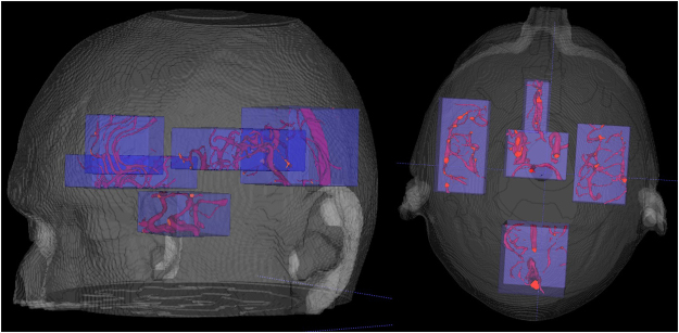 Figure 11