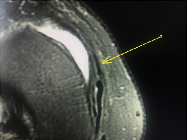 Fig. 5