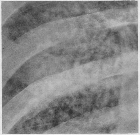 graphic file with name brjindmed00251-0048-c.jpg