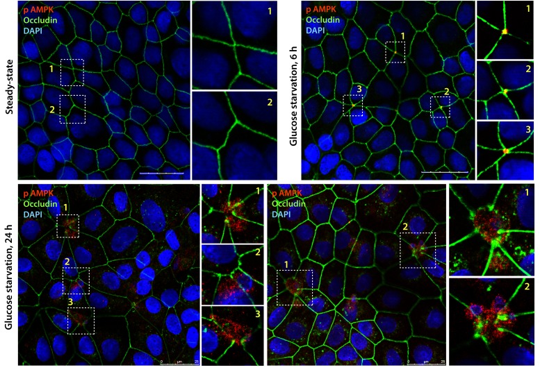 Figure 2—figure supplement 1.