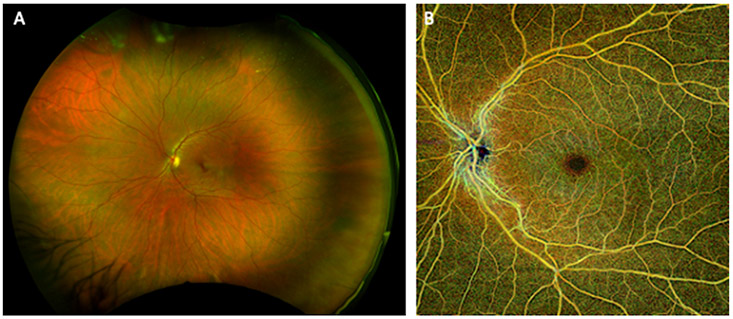 Fig. 2.