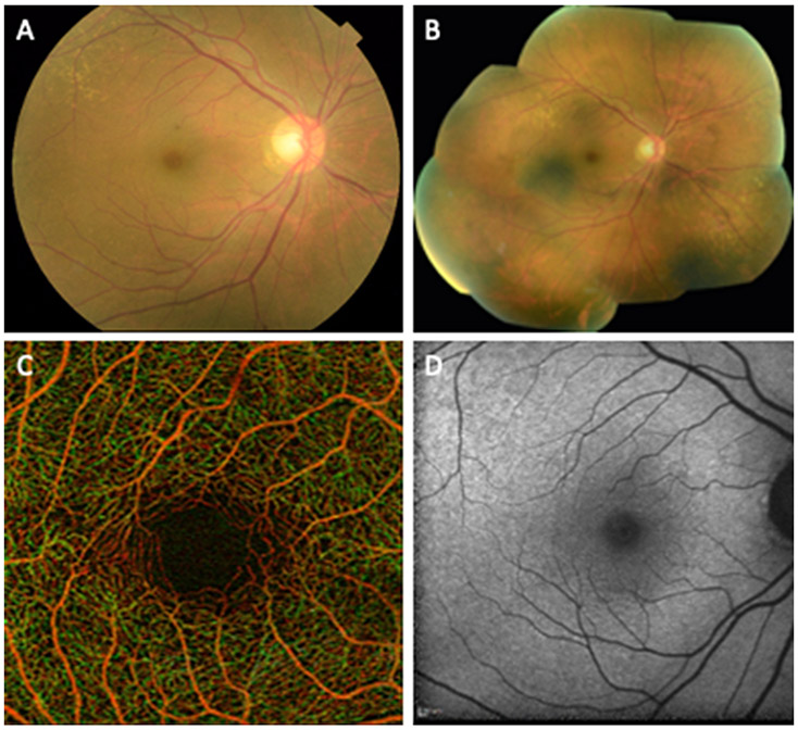 Fig. 1.