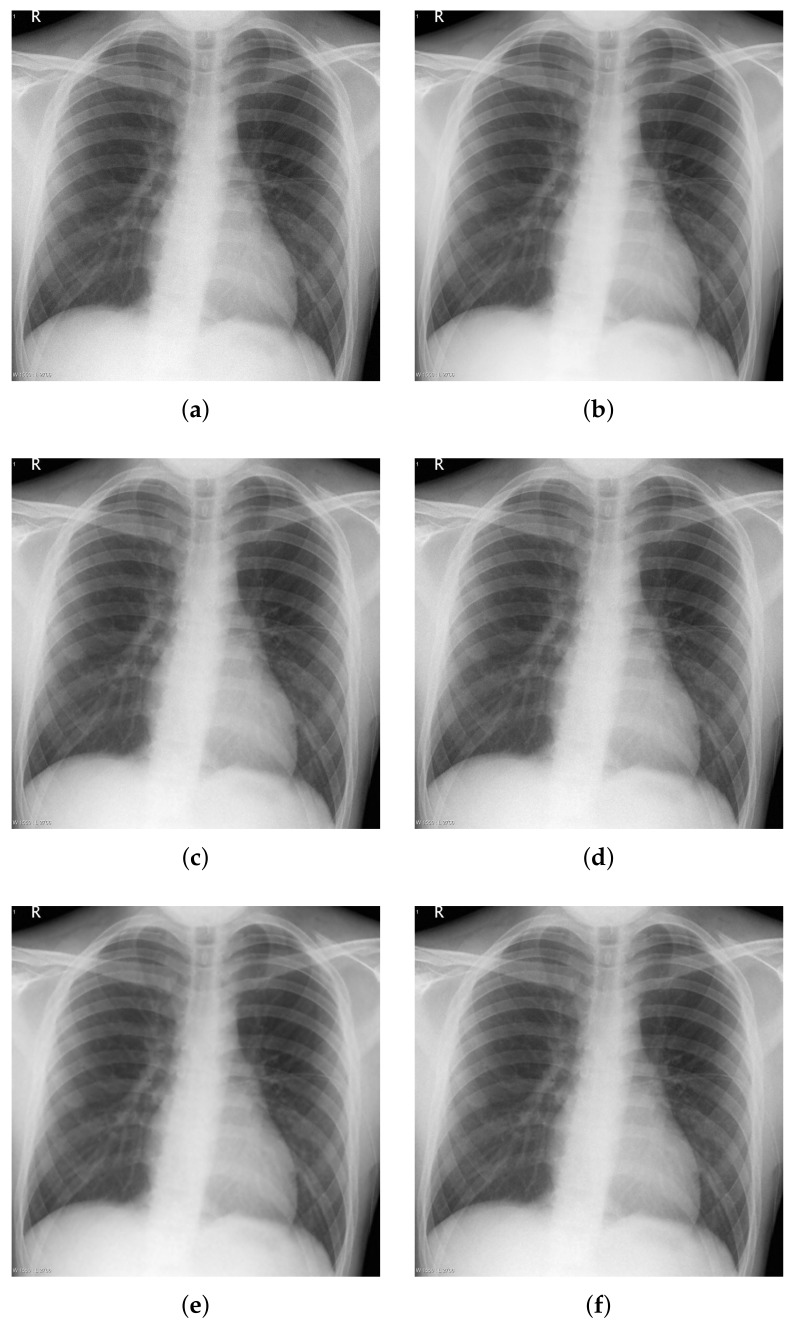 Figure 14