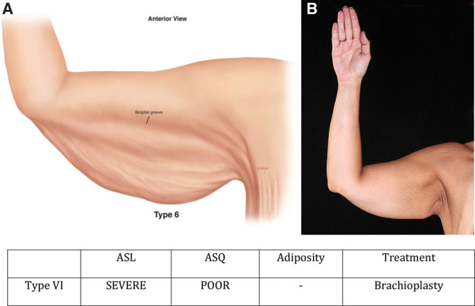 Fig. 10.