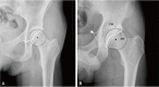 Fig. 16