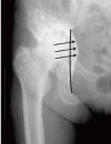 Fig. 14