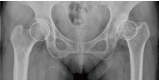 Fig. 17