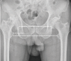 Fig. 11