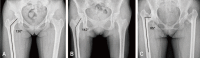 Fig. 12
