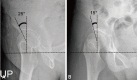 Fig. 19