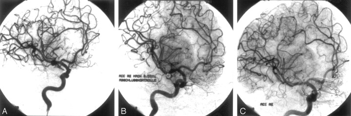 Fig 3.