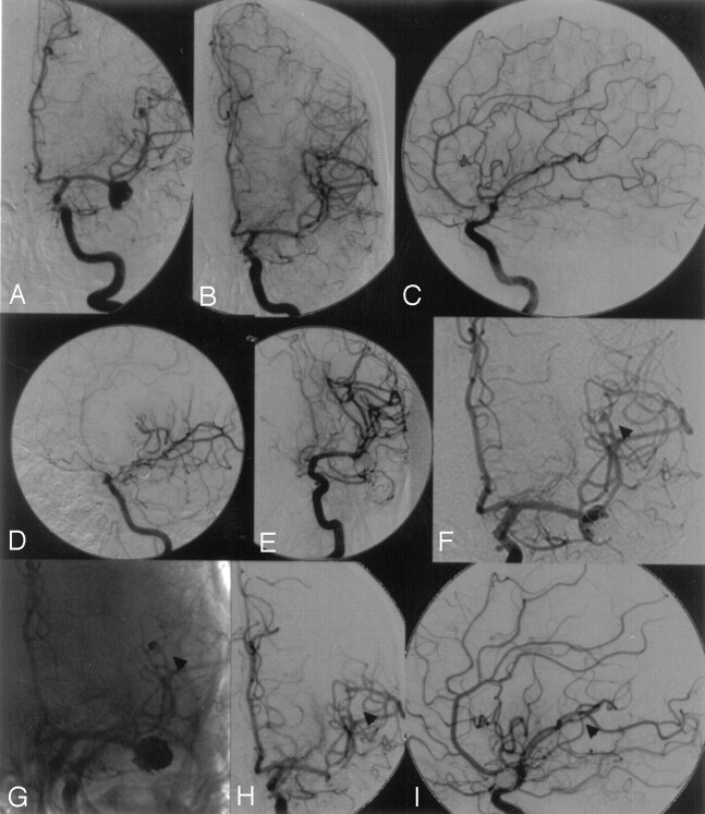 Fig 1.