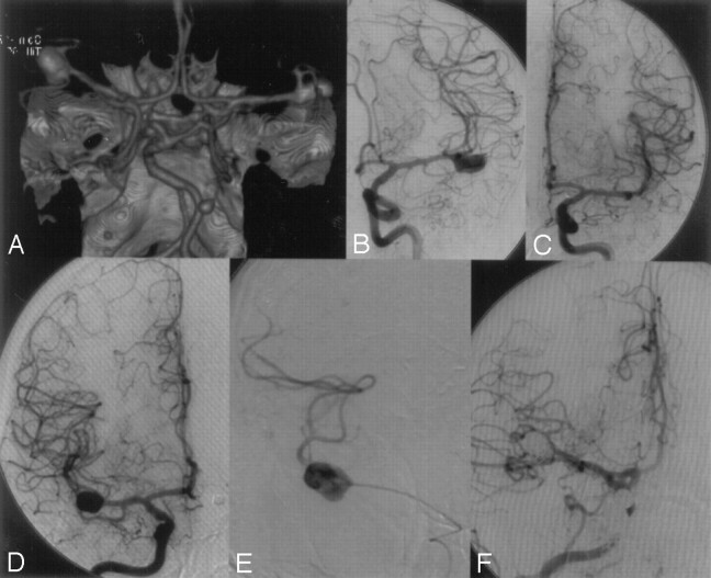 Fig 4.