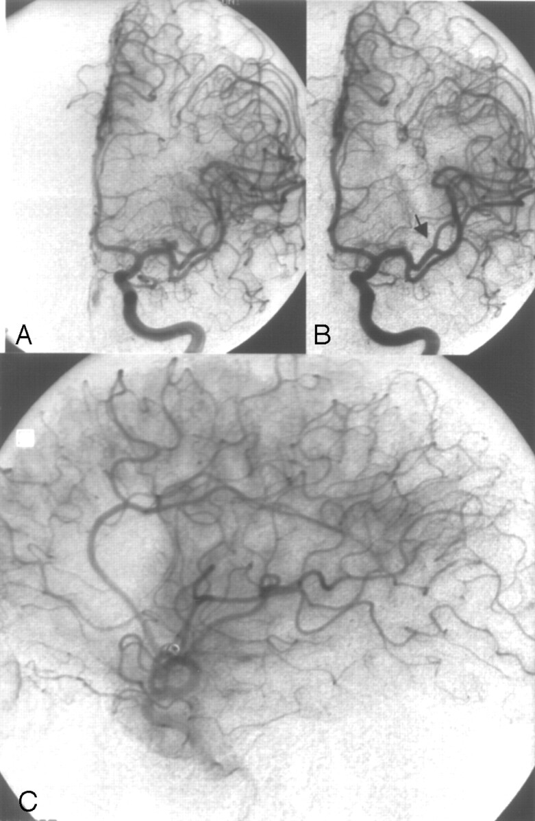 Fig 2.