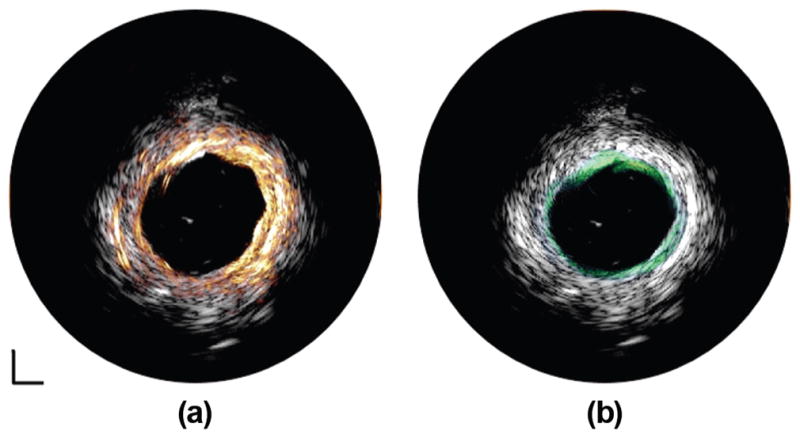 Fig. 10