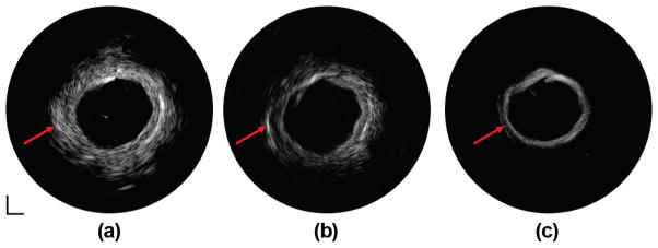 Fig. 9