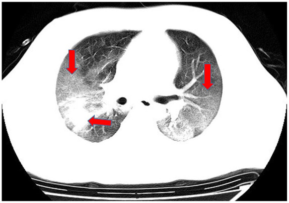 Figure 5.